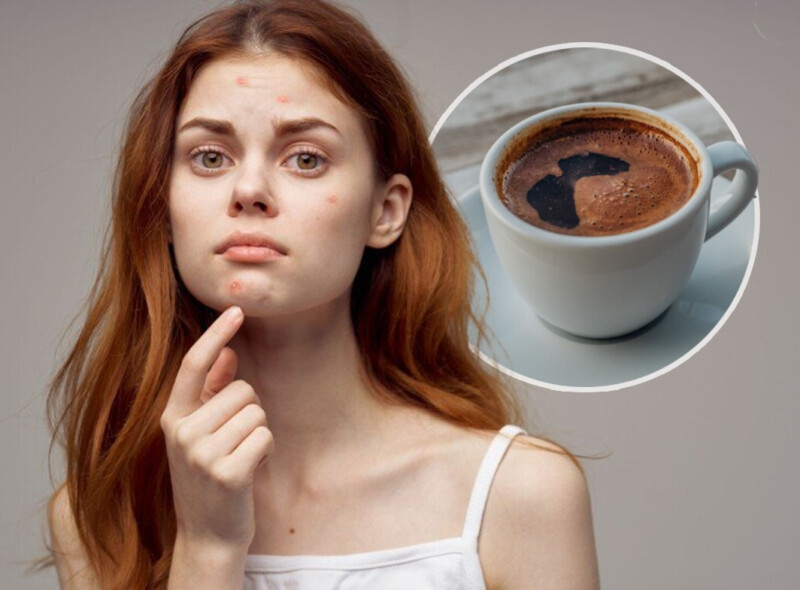 Ako imate ova tri simptoma, razmislite o prestajanju pijenja kafe